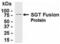 Small Glutamine Rich Tetratricopeptide Repeat Containing Alpha antibody, XW-8161, ProSci, Western Blot image 