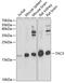 Tachykinin-3 antibody, A05391, Boster Biological Technology, Western Blot image 