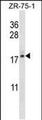 Transition Protein 2 antibody, PA5-48457, Invitrogen Antibodies, Western Blot image 