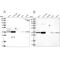 G-Patch Domain Containing 11 antibody, PA5-58306, Invitrogen Antibodies, Western Blot image 