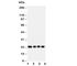 Fibroblast Growth Factor 22 antibody, R30527, NSJ Bioreagents, Western Blot image 