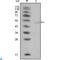 Lipoprotein Lipase antibody, LS-C812808, Lifespan Biosciences, Western Blot image 