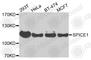 Spindle And Centriole Associated Protein 1 antibody, A7855, ABclonal Technology, Western Blot image 
