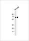 Transforming Growth Factor Beta Receptor 2 antibody, 56-081, ProSci, Western Blot image 