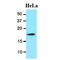 Cofilin 1 antibody, GTX57545, GeneTex, Western Blot image 