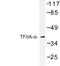 General Transcription Factor IIA Subunit 1 antibody, LS-C176913, Lifespan Biosciences, Western Blot image 