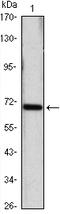 Heat Shock Protein Family A (Hsp70) Member 4 antibody, A03618, Boster Biological Technology, Western Blot image 