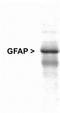 GFAP antibody, TA336708, Origene, Western Blot image 