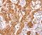 Neutral cholesterol ester hydrolase 1 antibody, PA5-50285, Invitrogen Antibodies, Immunohistochemistry frozen image 