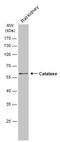 Catalase antibody, GTX113149, GeneTex, Western Blot image 