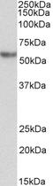 Alpha-1-antitrypsin antibody, LS-C204971, Lifespan Biosciences, Western Blot image 