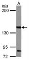 Colony Stimulating Factor 2 Receptor Beta Common Subunit antibody, NBP2-16954, Novus Biologicals, Western Blot image 