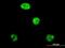 Adenosine Deaminase RNA Specific antibody, ab88574, Abcam, Immunofluorescence image 