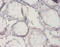 Interleukin 18 Binding Protein antibody, A52146-100, Epigentek, Immunohistochemistry paraffin image 