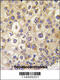 Rho Family GTPase 3 antibody, 63-181, ProSci, Immunofluorescence image 