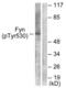 FYN Proto-Oncogene, Src Family Tyrosine Kinase antibody, LS-C198983, Lifespan Biosciences, Western Blot image 