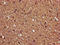 Protein Phosphatase 2 Regulatory Subunit Bbeta antibody, LS-C376380, Lifespan Biosciences, Immunohistochemistry paraffin image 