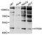 5-Hydroxytryptamine Receptor 3B antibody, abx125973, Abbexa, Western Blot image 