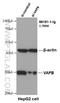 Vesicle-associated membrane protein-associated protein B antibody, 66191-1-Ig, Proteintech Group, Western Blot image 