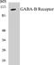 Gamma-Aminobutyric Acid Type B Receptor Subunit 1 antibody, EKC1230, Boster Biological Technology, Western Blot image 