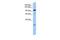 Adaptor Related Protein Complex 2 Subunit Beta 1 antibody, GTX45495, GeneTex, Western Blot image 