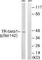 Thyroid Hormone Receptor Beta antibody, TA311779, Origene, Western Blot image 