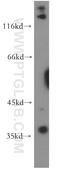 TNF Alpha Induced Protein 1 antibody, 15320-1-AP, Proteintech Group, Western Blot image 