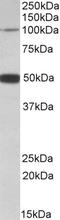 Patched Domain Containing 1 antibody, EB10466, Everest Biotech, Western Blot image 