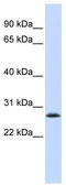 LSM12 Homolog antibody, TA338823, Origene, Western Blot image 