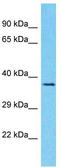 Olfactory Receptor Family 1 Subfamily J Member 4 antibody, TA337479, Origene, Western Blot image 