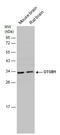 OTU Deubiquitinase, Ubiquitin Aldehyde Binding 1 antibody, GTX133347, GeneTex, Western Blot image 