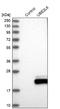 Ubiquitin Conjugating Enzyme E2 L6 antibody, NBP1-86885, Novus Biologicals, Western Blot image 