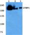 Latent Transforming Growth Factor Beta Binding Protein 1 antibody, A03224, Boster Biological Technology, Western Blot image 