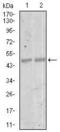 Myocyte-specific enhancer factor 2C antibody, MA5-17119, Invitrogen Antibodies, Western Blot image 