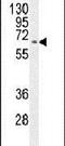 Kyphoscoliosis Peptidase antibody, PA5-23914, Invitrogen Antibodies, Western Blot image 