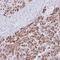 Proteasome 20S alpha 3 antibody, orb73724, Biorbyt, Immunohistochemistry paraffin image 