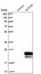 Solute Carrier Family 51 Beta Subunit antibody, PA5-52574, Invitrogen Antibodies, Western Blot image 