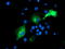 Proteasome 26S Subunit, Non-ATPase 2 antibody, TA503220, Origene, Immunofluorescence image 