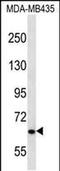 Nephrocystin 3 antibody, PA5-48439, Invitrogen Antibodies, Western Blot image 