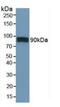 CD36 Molecule antibody, MBS2013144, MyBioSource, Western Blot image 