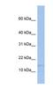 Trafficking Protein Particle Complex 2 antibody, NBP1-79379, Novus Biologicals, Western Blot image 