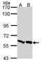 6-Phosphofructo-2-Kinase/Fructose-2,6-Biphosphatase 3 antibody, TA308467, Origene, Western Blot image 