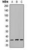 Nuclear Receptor Interacting Protein 2 antibody, abx121537, Abbexa, Western Blot image 