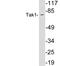 Mitogen-Activated Protein Kinase Kinase Kinase 7 antibody, LS-C200017, Lifespan Biosciences, Western Blot image 