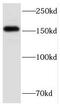 Formin-like protein 1 antibody, FNab03167, FineTest, Western Blot image 