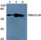 T-Box 18 antibody, A06044, Boster Biological Technology, Western Blot image 