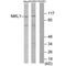 Myocardin Related Transcription Factor A antibody, PA5-49866, Invitrogen Antibodies, Western Blot image 