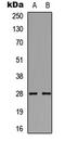 BMP And Activin Membrane Bound Inhibitor antibody, LS-C354285, Lifespan Biosciences, Western Blot image 