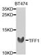 Trefoil Factor 1 antibody, MBS126297, MyBioSource, Western Blot image 