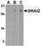 ORAI Calcium Release-Activated Calcium Modulator 2 antibody, TA306419, Origene, Western Blot image 